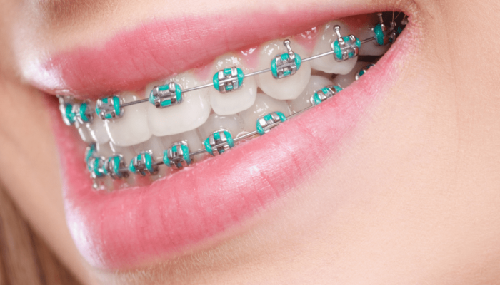 Dizajn-bez-naslova-74