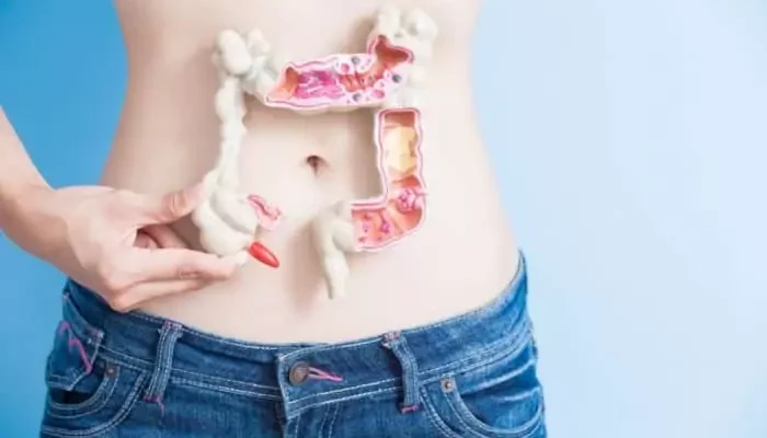 rak-debelog-creva-metastaze-e1522665987511