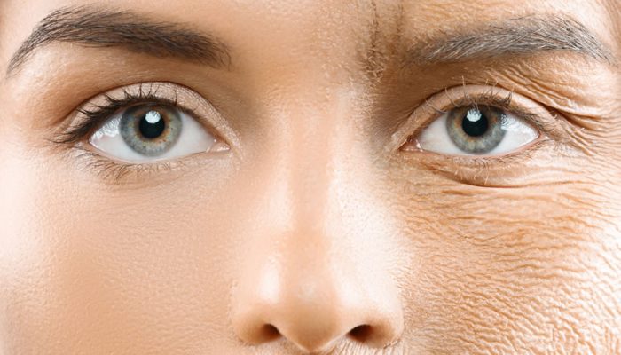 uklanjanje-bora-i-oziljaka-na-licu